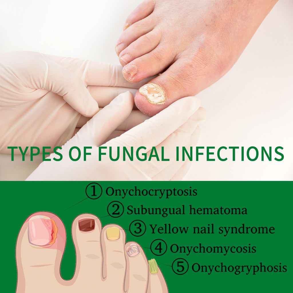 Ingwer Nagelpflege-Fluid