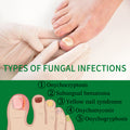 Ingwer Nagelpflege-Fluid – Ansicht 2