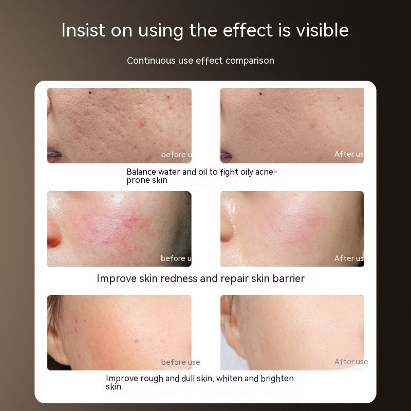 Photon IPL LED Maske für Hautverjüngung
