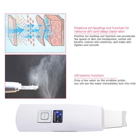Ultraschall-Hautpeeling & Mitesserentferner – Bild 6 | LuxeStyle