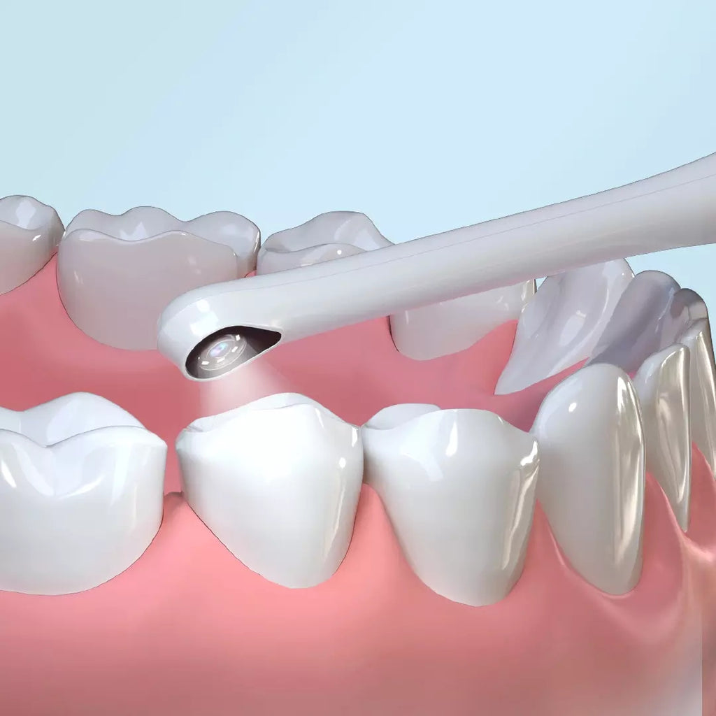 Smart Dental-Endoskop mit HD-Kamera – Bild 2 | LuxeStyle