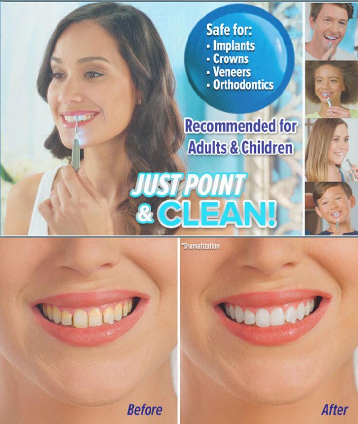 Ultraschall-Zahnreiniger mit LED – Bild 2 | LuxeStyle