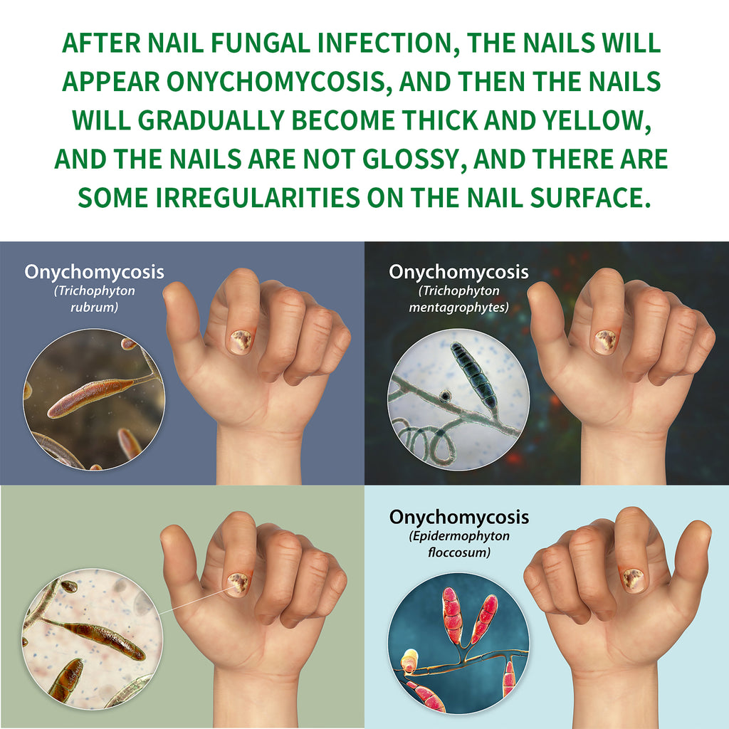 Ingwer Nagelpflege-Fluid