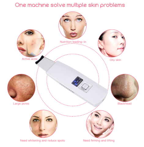 Ultraschall-Hautpeeling & Mitesserentferner – Bild 4 | LuxeStyle