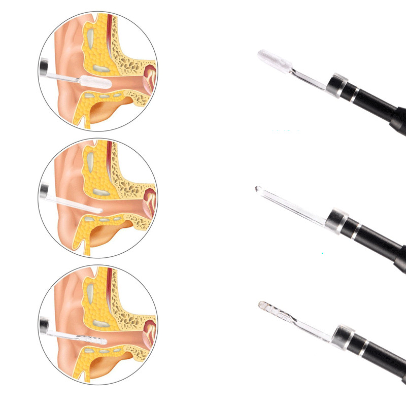 3-in-1 Ohrenschmalzentferner mit Kamera