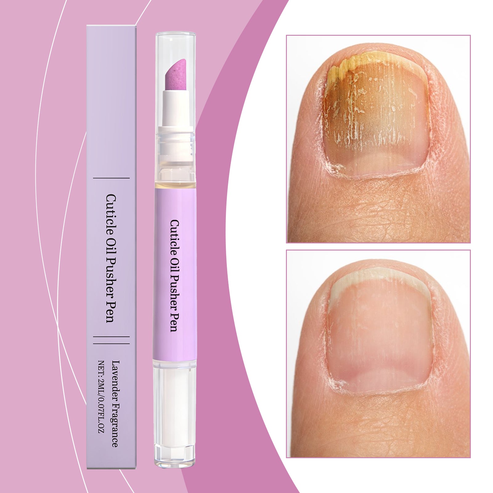 Nagel- und Nagelhautpflegeöl Stift – Ansicht 7