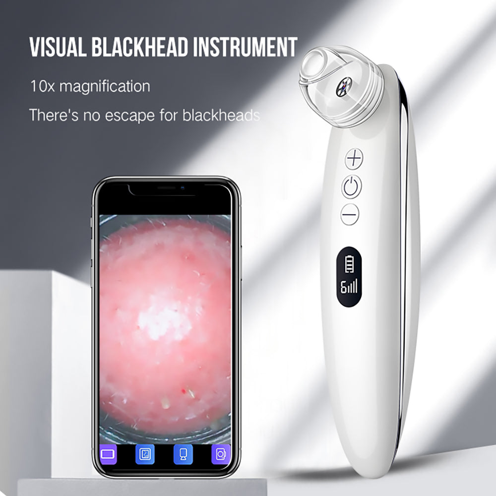Blackhead-Entferner mit 3 Stufen & 1 Mio. Leica-Linse