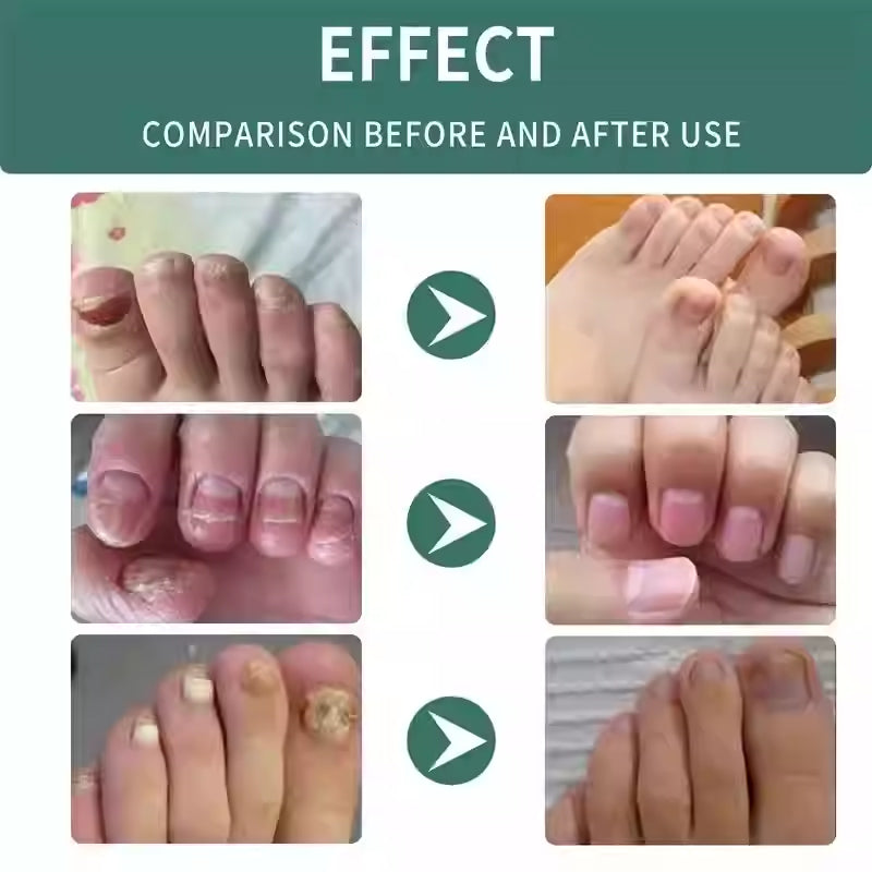 Nagelpilz-Reparaturserum – Ansicht 4