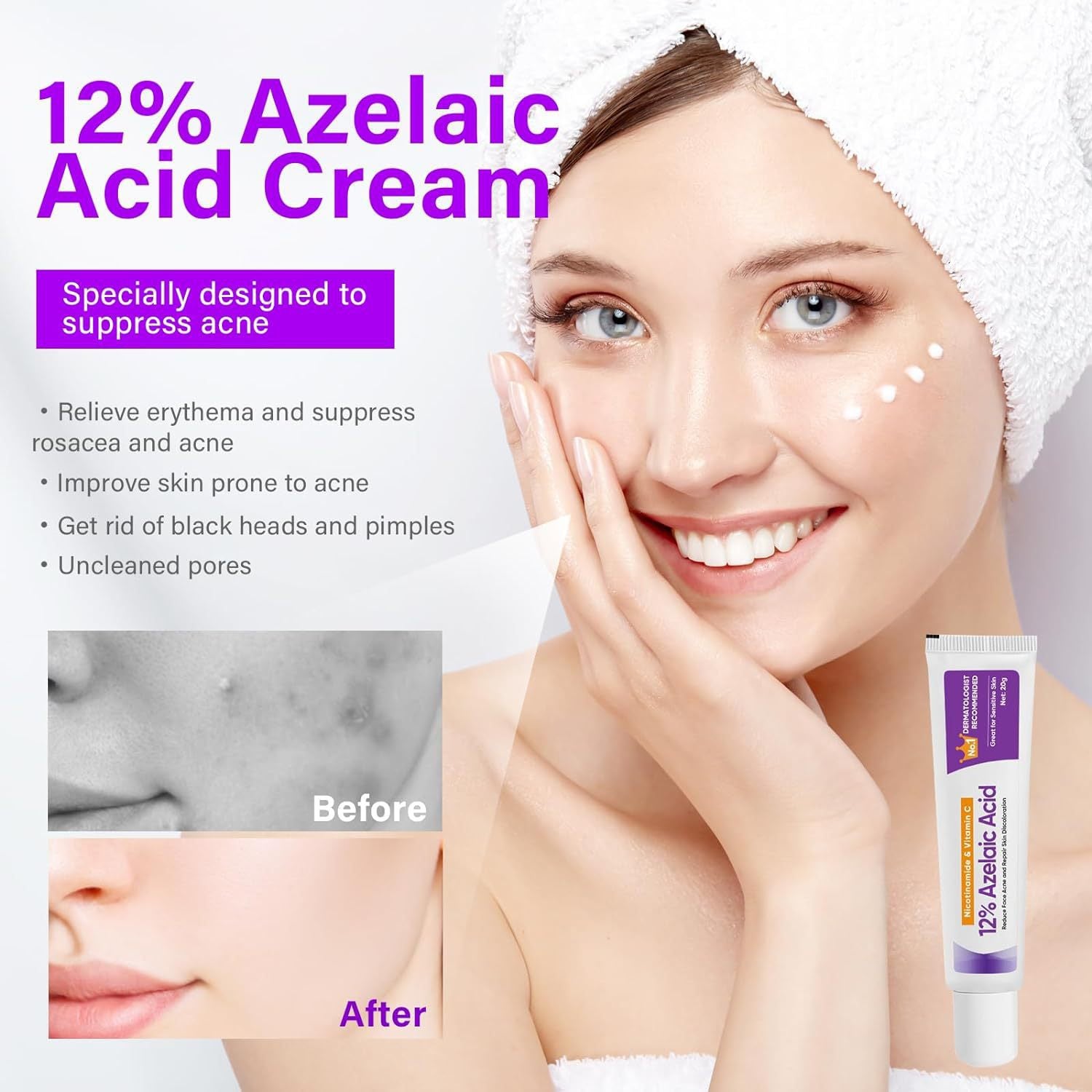 Azelaic Acid & Niacinamide Serum