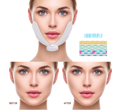 V-Shape Gesichtsstraffer mit EMS