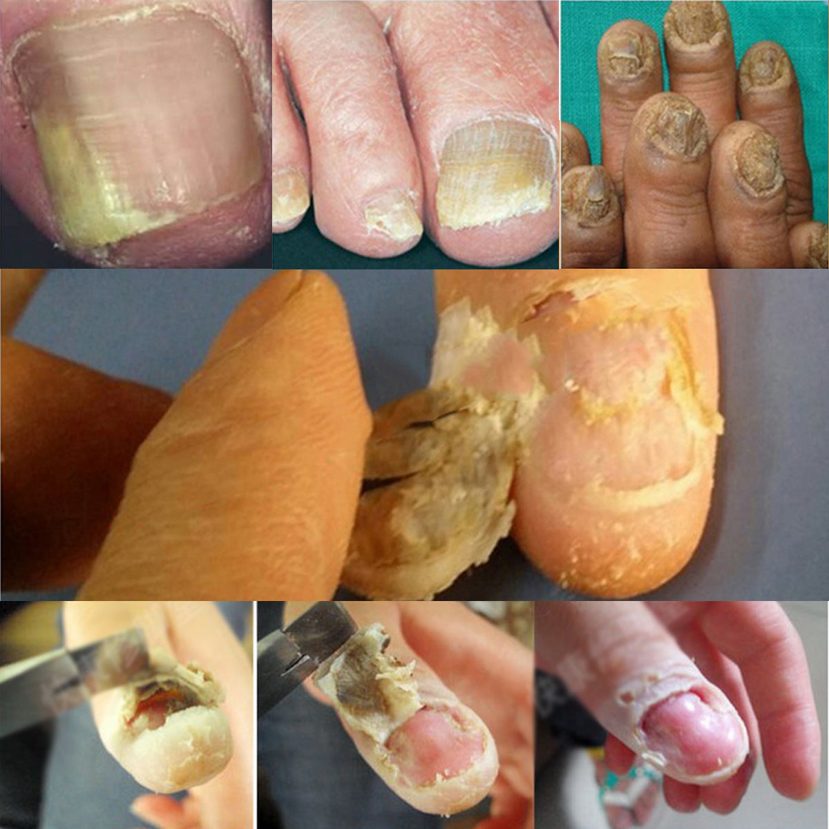 Nagelentferner Creme