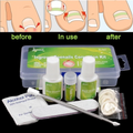Nagelkorrektur-Pflaster-Set