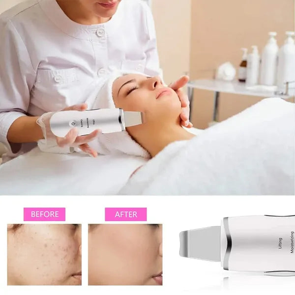 3-in-1 Ultraschall-Gesichtsspatel für Tiefenreinigung