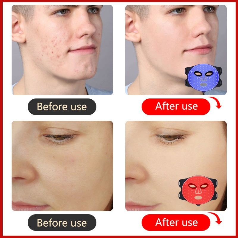 LED Lichttherapie Gesichtsmaske – Bild 4 | LuxeStyle