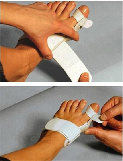 Hallux Valgus Korrektor mit Zehenspreizer