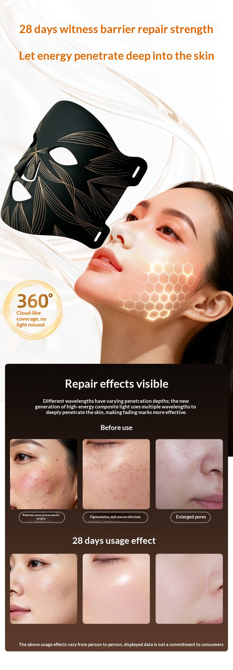 Photon Gesichtsmaske – Ansicht 6