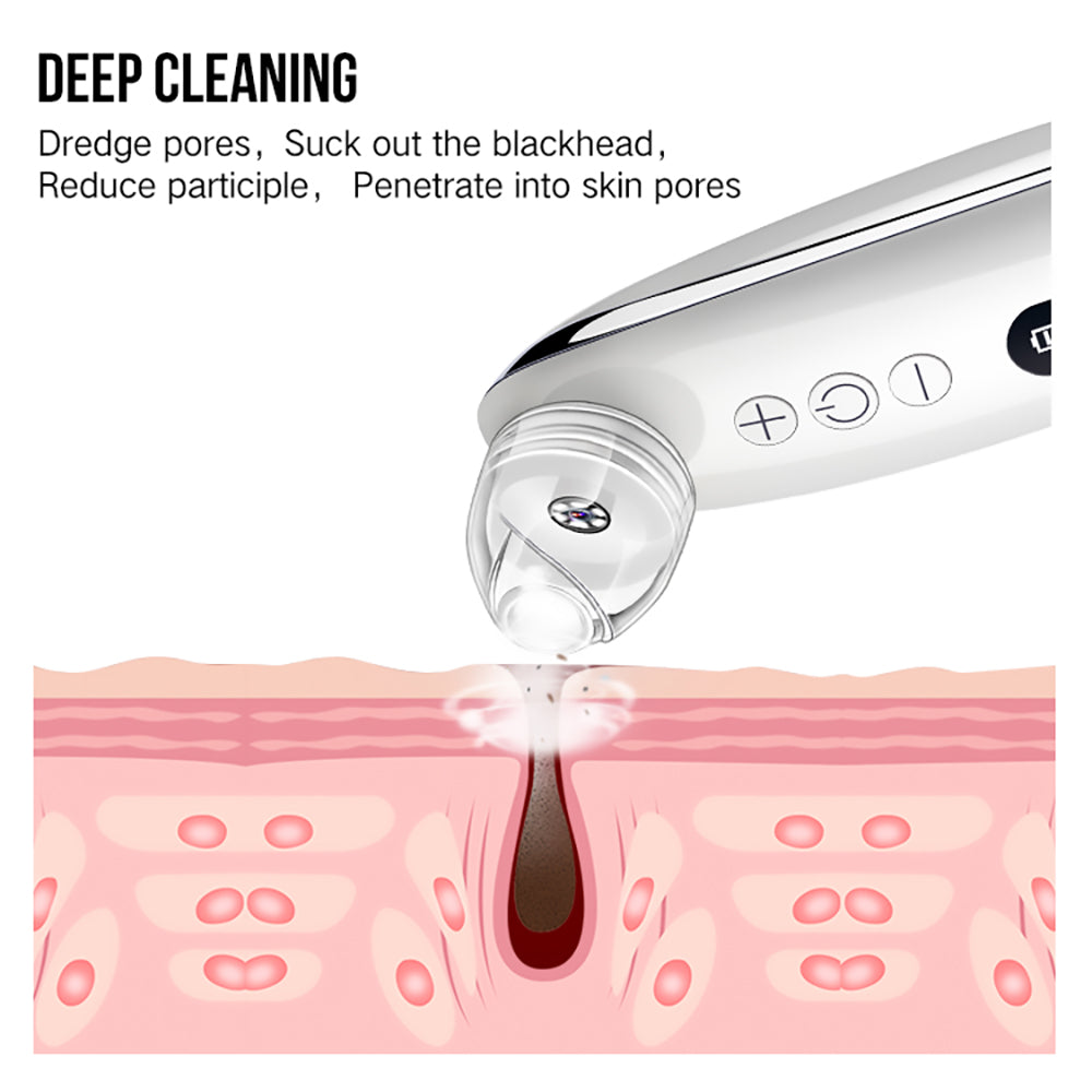 Blackhead-Entferner mit 3 Stufen & 1 Mio. Leica-Linse
