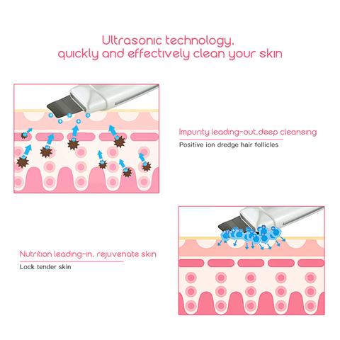 Ultraschall-Hautpeeling & Mitesserentferner – Bild 2 | LuxeStyle