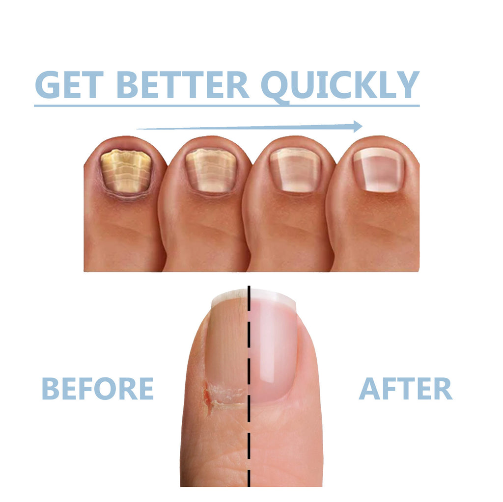 Nagelpflege Set