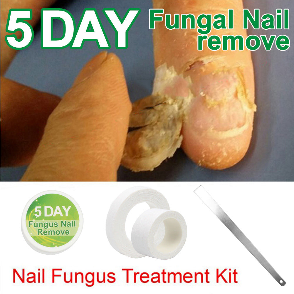 Nagelentferner Creme