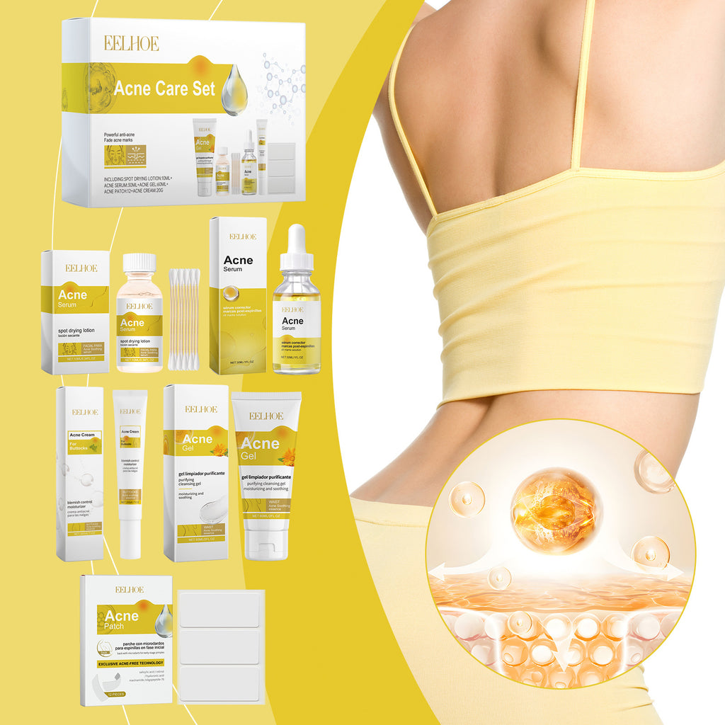 Akne Hautpflege-Set – Bild 2 | LuxeStyle