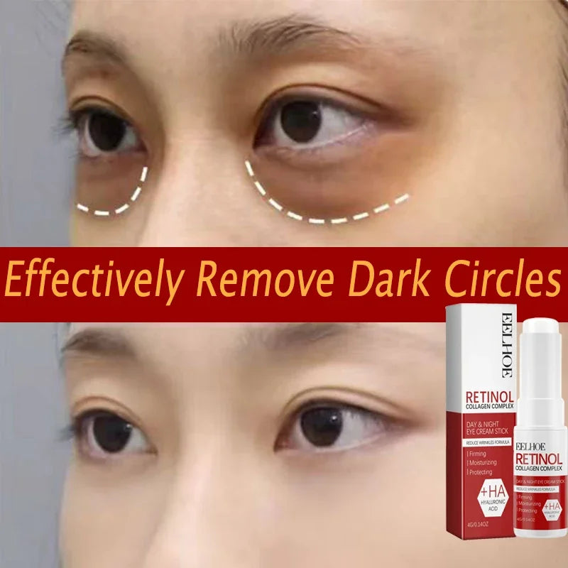 Augencreme Koffein Anti-Aging