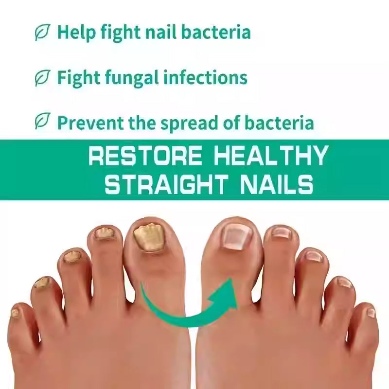 Nagelpilz-Reparaturserum – Ansicht 2