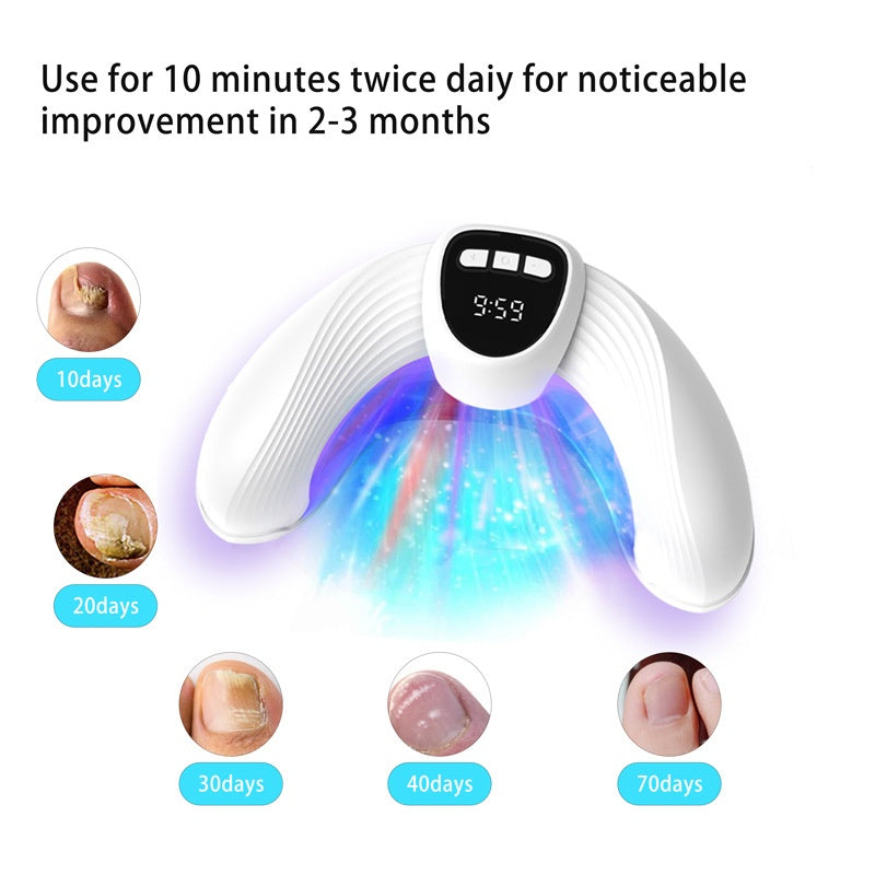 U-förmiges portables Nagel-Lichttherapiegerät – Ansicht 5