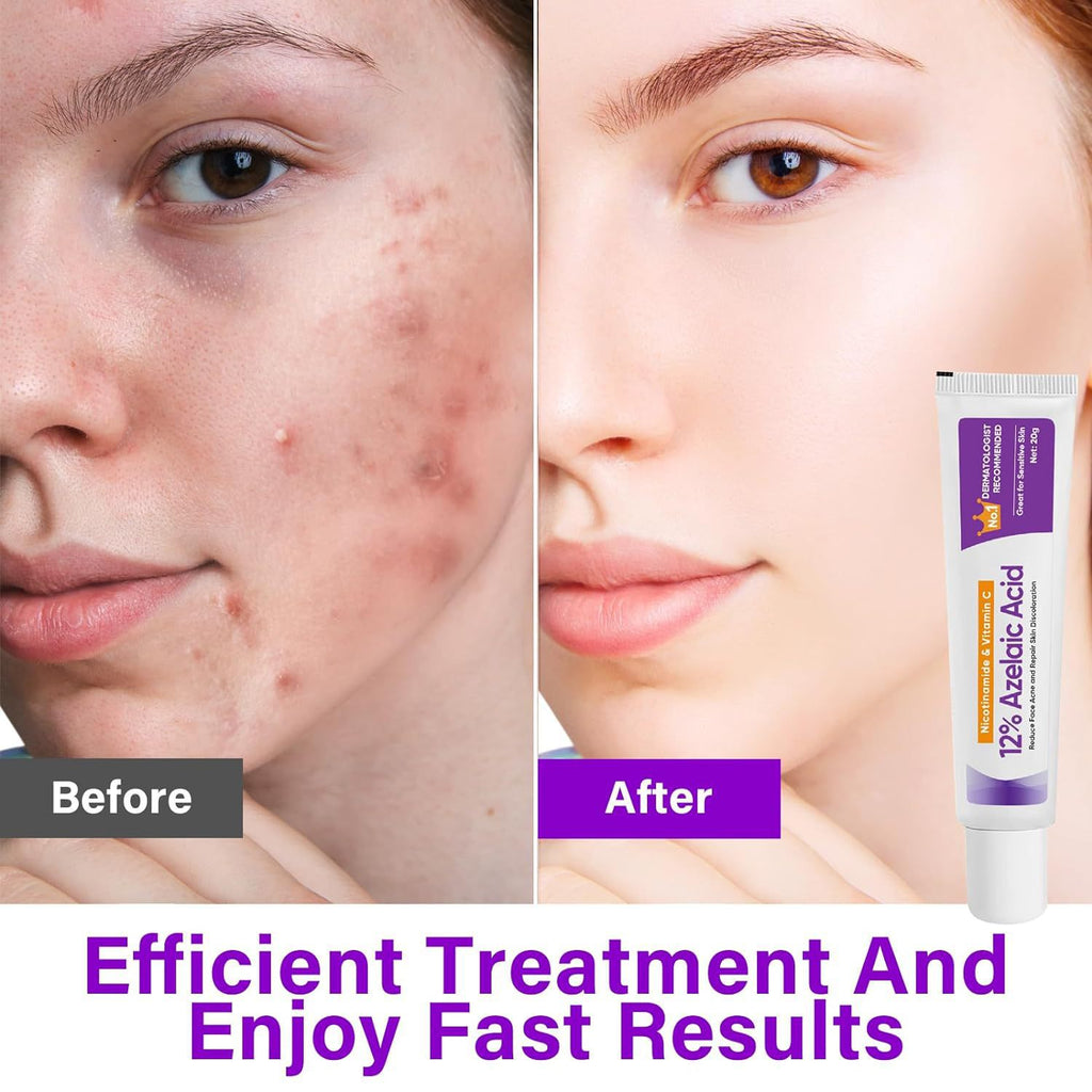 Azelaic Acid & Niacinamide Serum