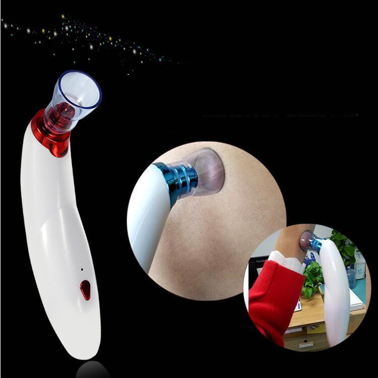 Blackhead-Entferner mit Saugfunktion