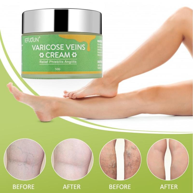 Vein Cream gegen Besenreiser & Krampfadern